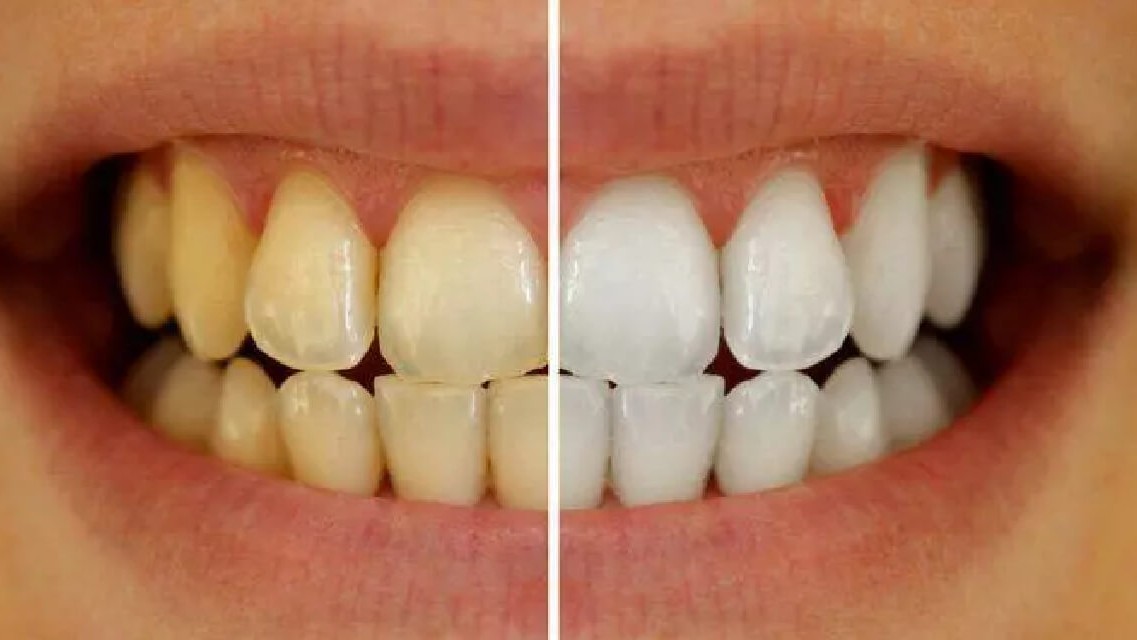 blog-post-image